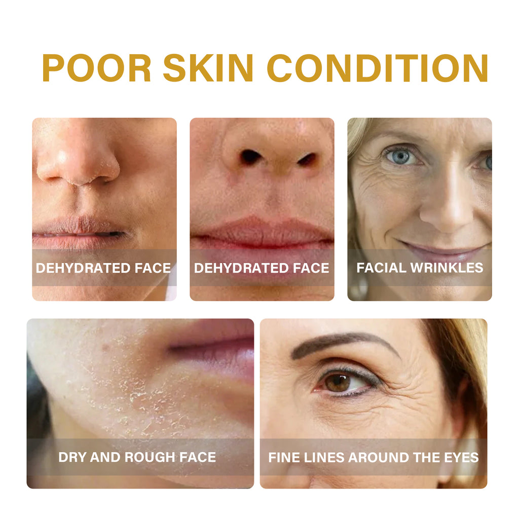 EELHOE Collagen Essence Improves Facial Skin, Lightens Fine Lines, Hydrates And Firms The Skin