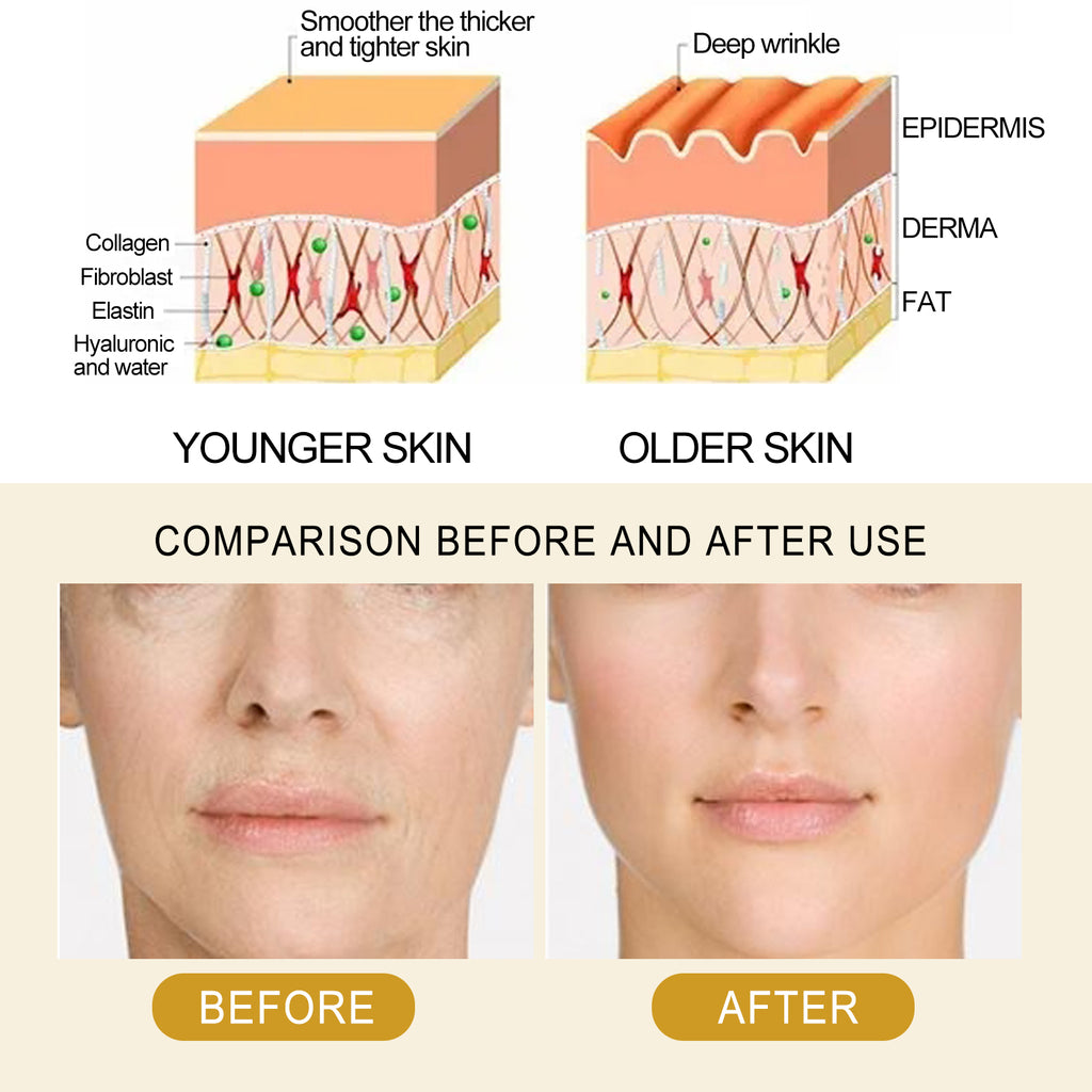 EELHOE Collagen Essence Improves Facial Skin, Lightens Fine Lines, Hydrates And Firms The Skin