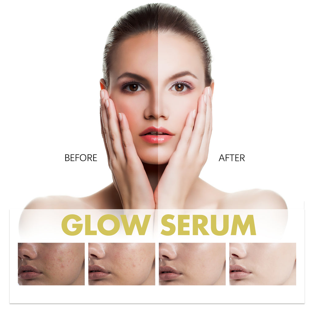 Hoygi Glow Serum, Moisturizing And Whitening Skin To Reduce Facial Spots And Fine Lines